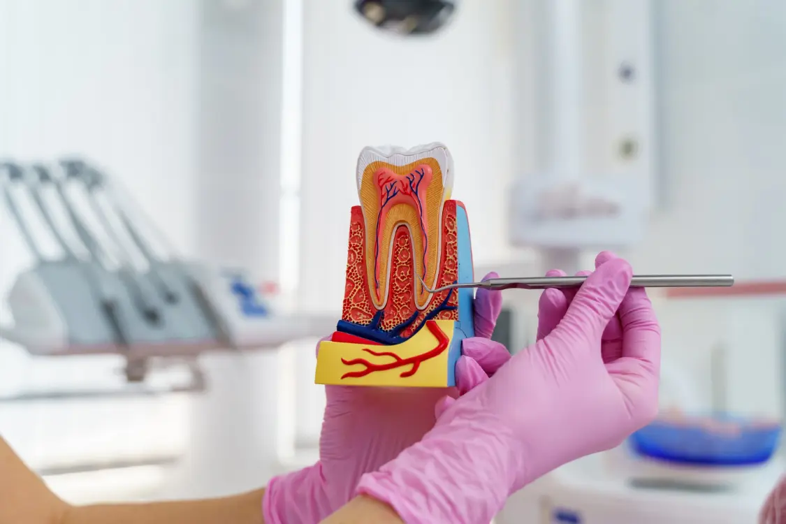 Modello anatomico della radice del dente usato per spiegare il trattamento endodontico