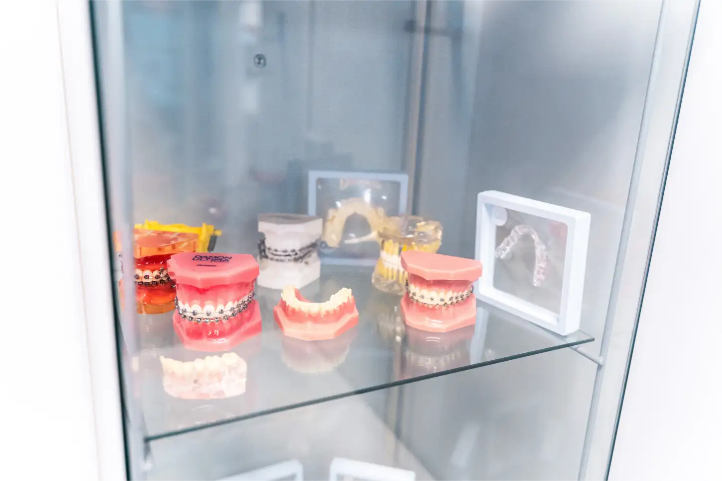 Campionario di apparecchi ortodontici e bite esposto in Studio Dentistico Isaza a Bologna