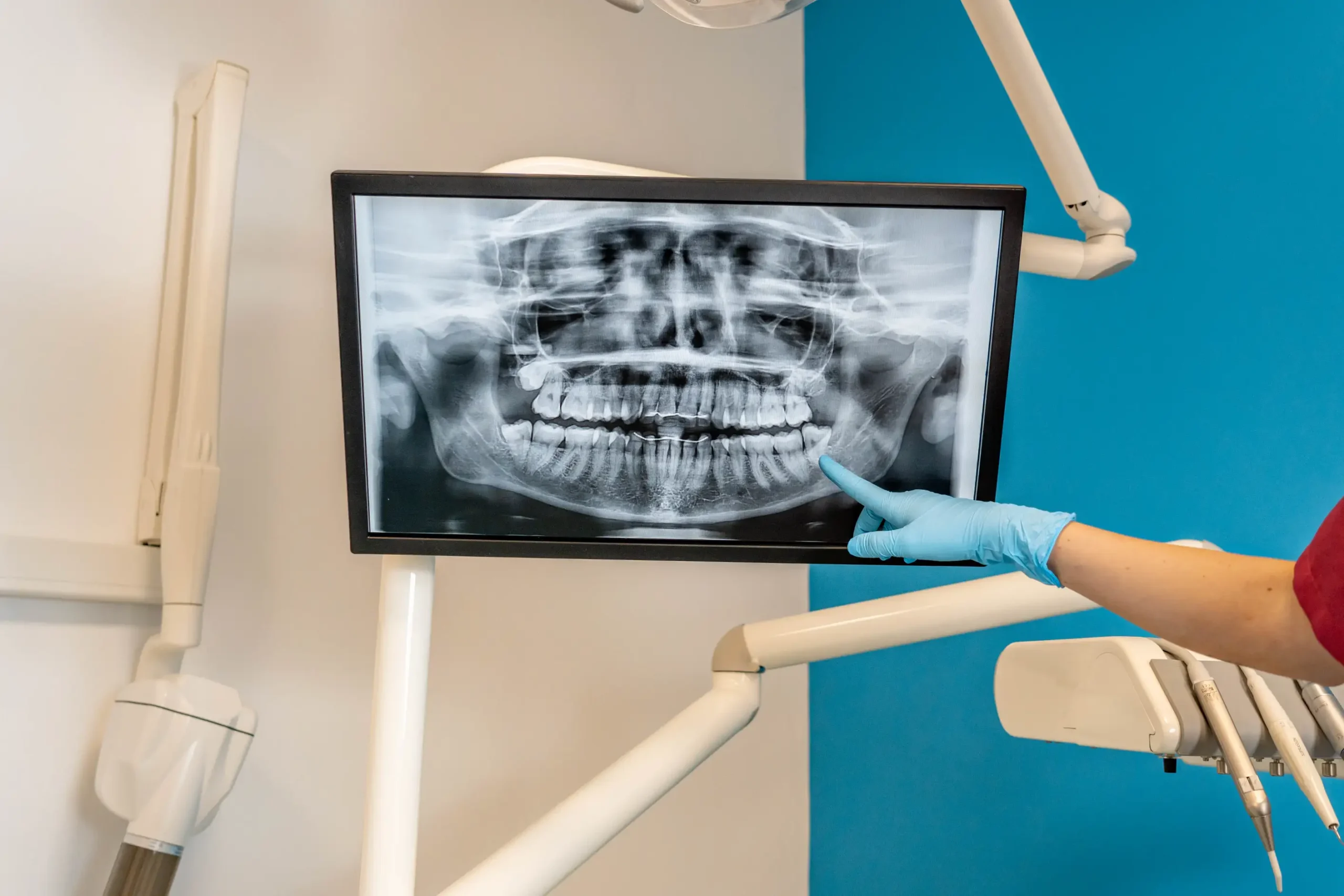 Dentista che analizza radiografia panoramica dentale su schermo